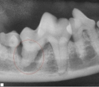 Tooth root abscess