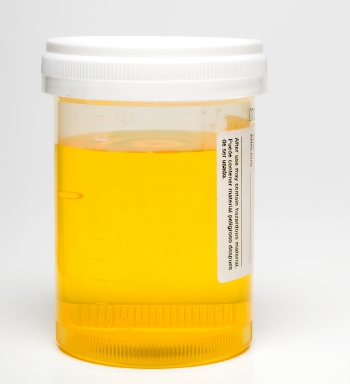 urine sample collect dog cat pee liquid vet blood dogs does going medical preventivevet health cats help peeing which read