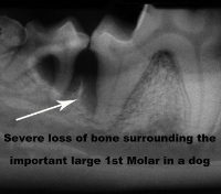 Periodontal disease bone loss