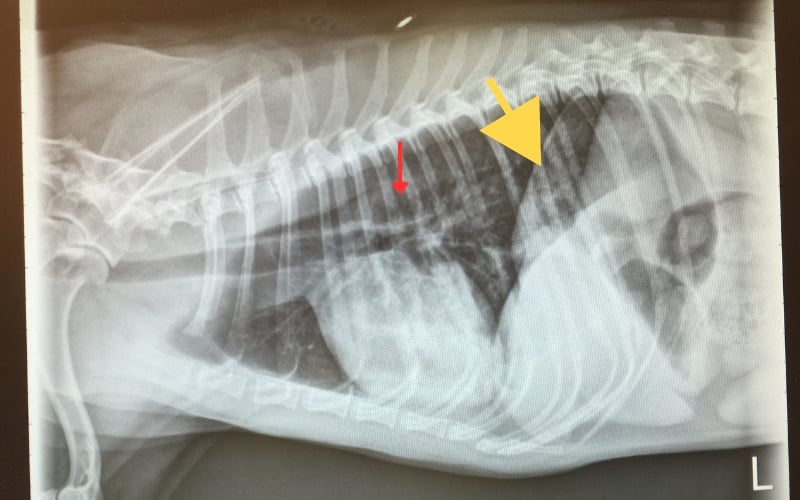 aspiration pneumonia x-ray left side