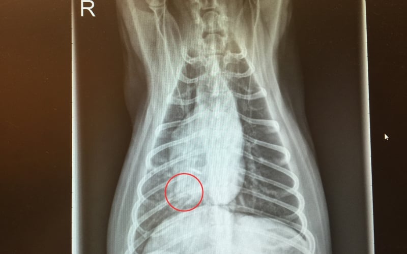 aspiration pneumonia x-ray right front side