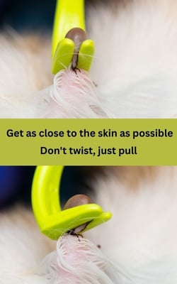 removing a tick safely-shutter