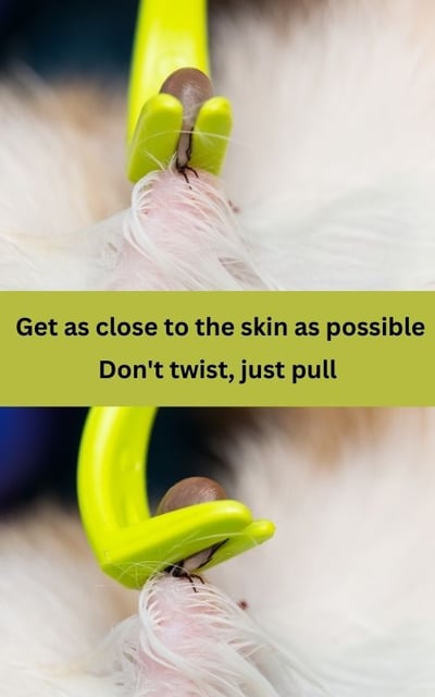 removing a tick safely
